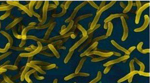 微生物菌劑好？好在哪里您知道嗎？